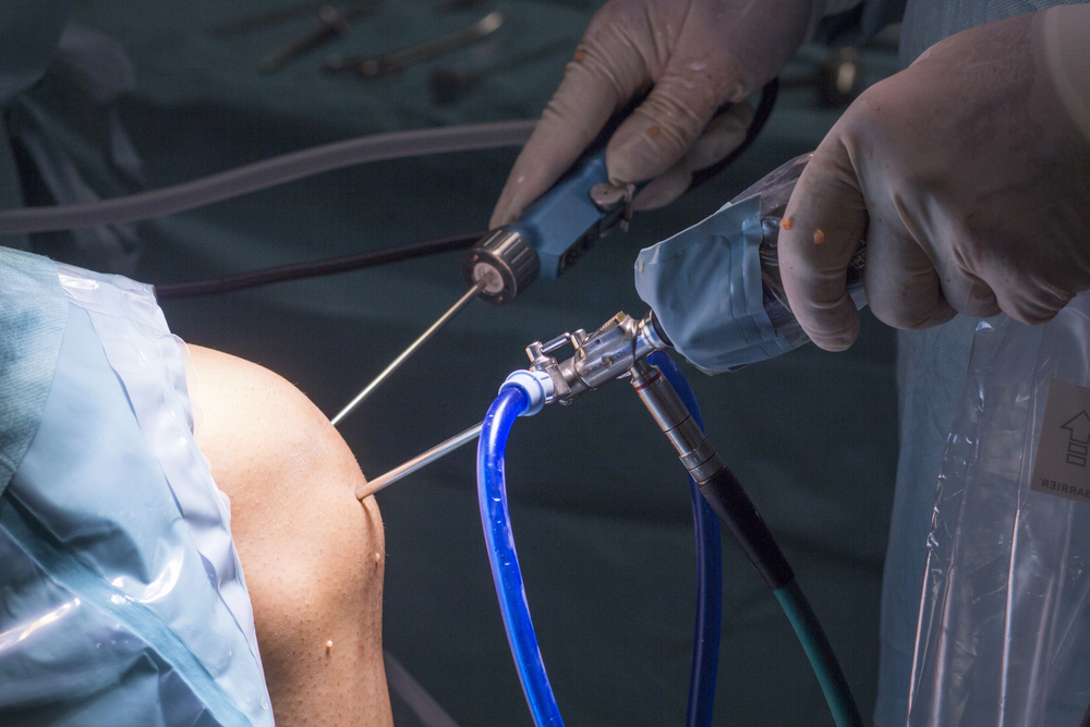 4ed8644a443a1edcc2e669a31b0190cb7839df39